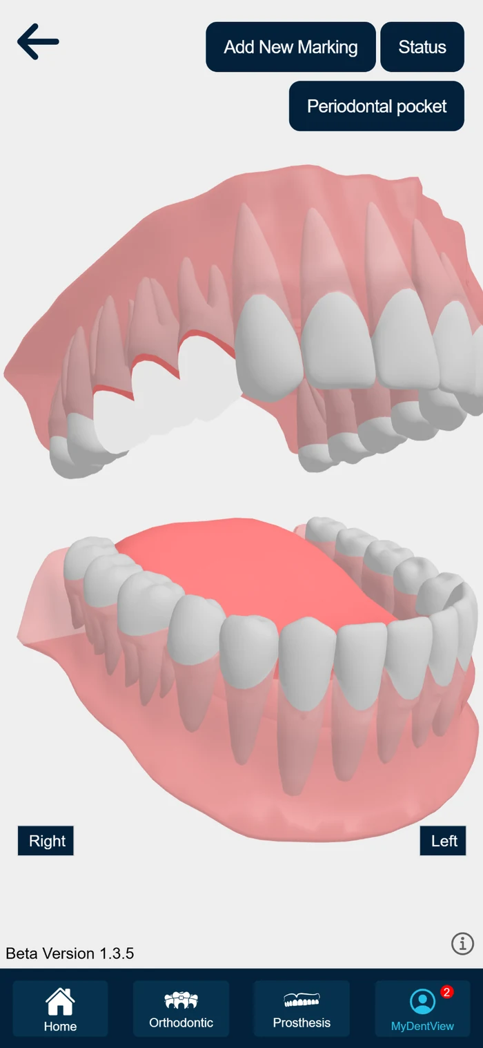 MyDentView 3D dental status on a patient's phone