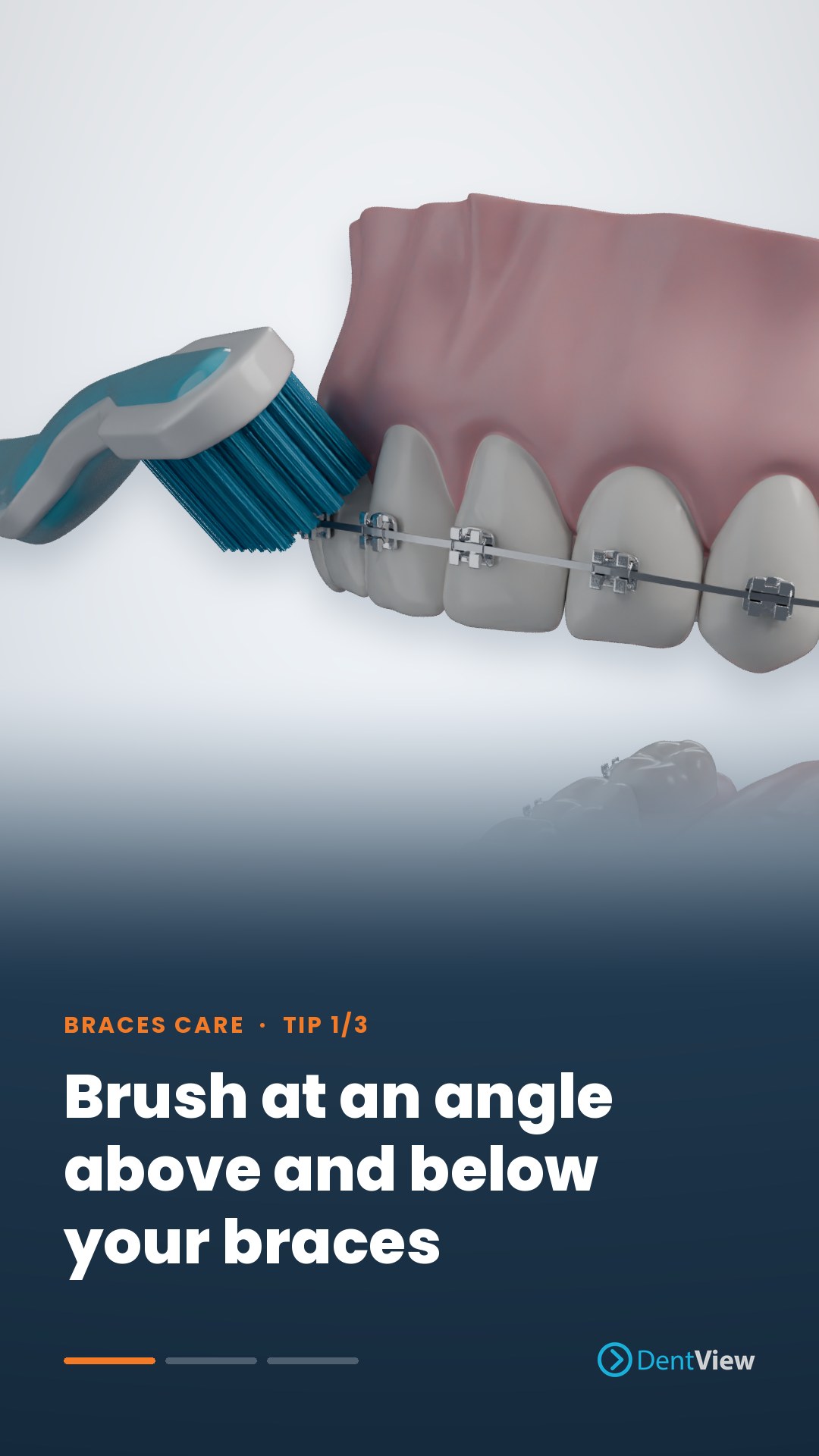 Braces care tip in 3D: brush at an angle above and below your braces